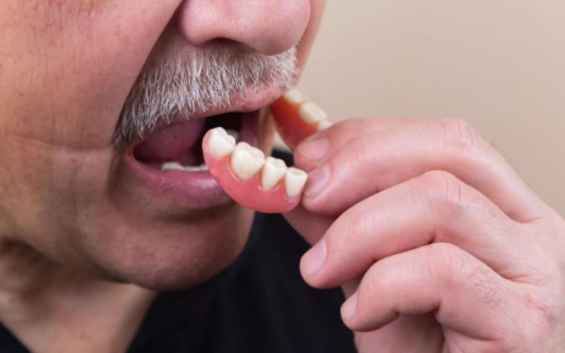 What Affects the Cost of Full Mouth Dental Implants