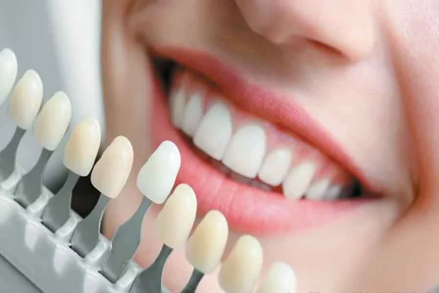 Cosmetic Dentistry