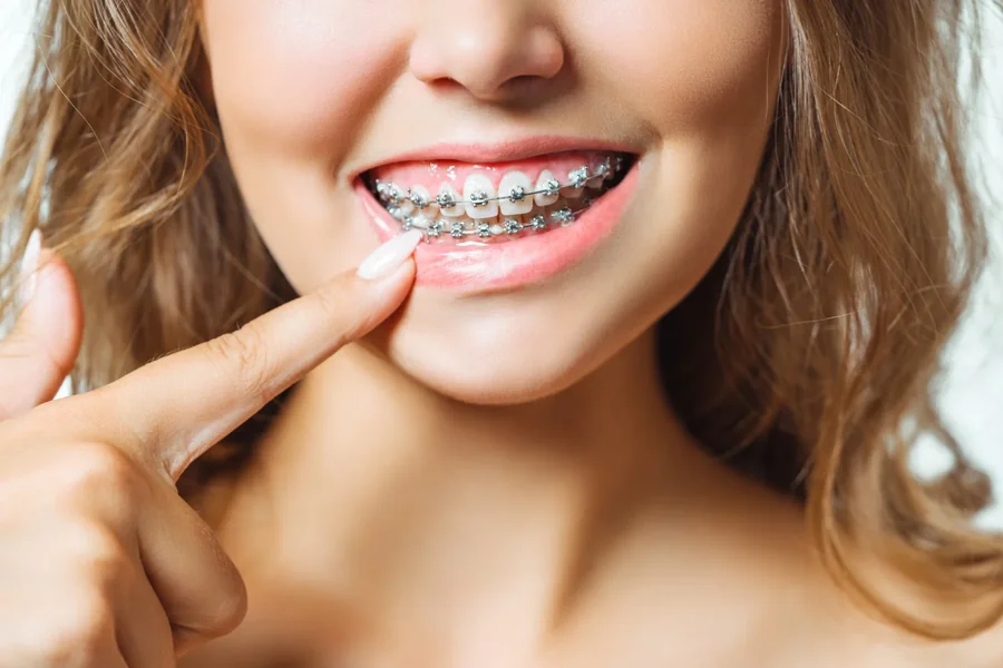 Jaw Alignment