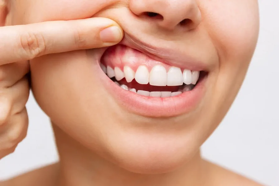 5 Preventive Dentistry Practices That Protect Against Gum Disease