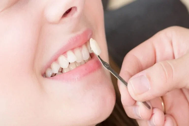 3 Cosmetic Dentistry Treatments That Can Be Completed In A Single Visit