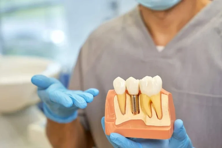 How Implant Dentists Build Confidence Through Lasting Restorations